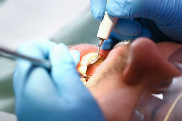 Best Walk-In Emergency Dental Services in Durham, NC